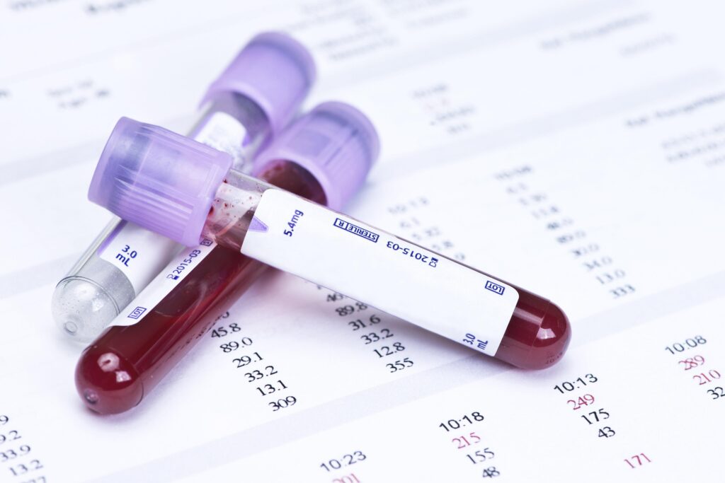 epidemiologia sangre